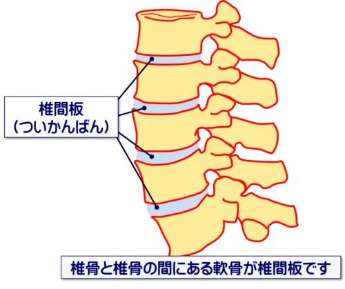 椎間板の膨張