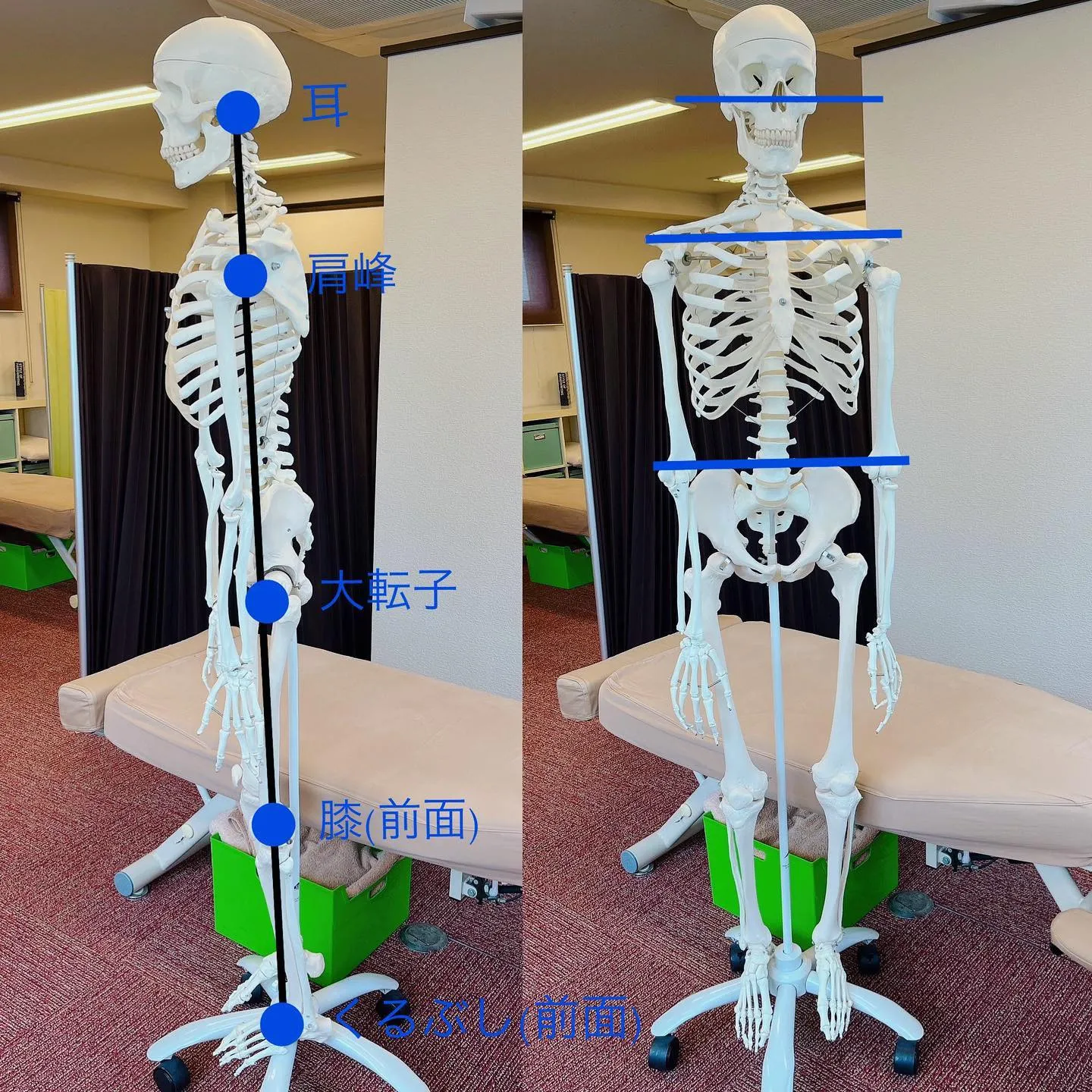 身体の歪みをセルフチェック！解消する生活習慣のアドバイスも紹介