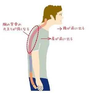 巻き肩の簡単な治し方3選｜誰でもすぐできるストレッチ＆姿勢改善