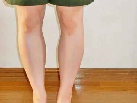 【O脚調整】骨って生まれ変わる？！